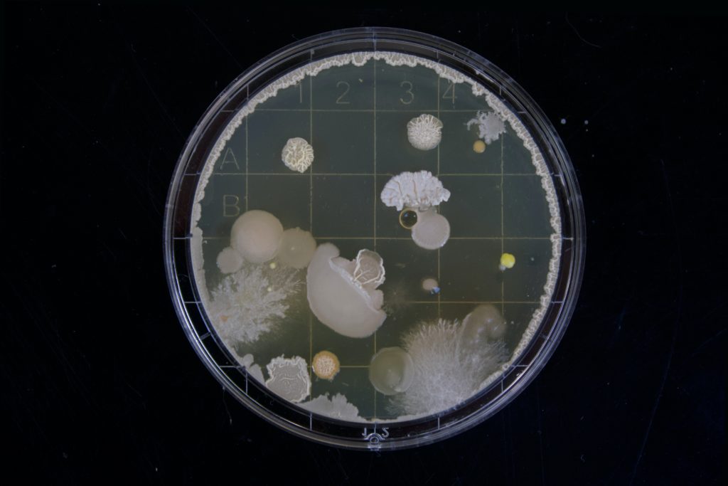 A friend of mine had to do some bacteria samples during her bachelor thesis. When i saw those i was instantly fascinated by the vast range of variation within this tiny microcosm.