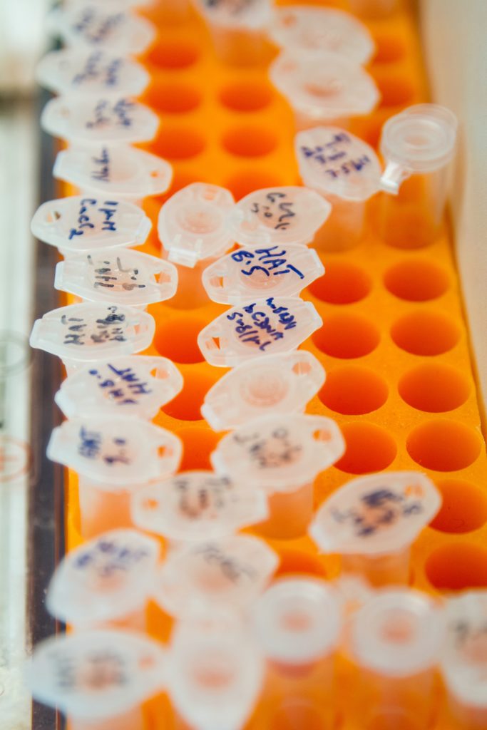 Microcentrifuge tubes in a rack. Some of them are DNA samples while the remainder of them are primers to be used in polymerase chain reaction, or PCR, a laboratory technique used to make multiple copies of a segment of DNA.